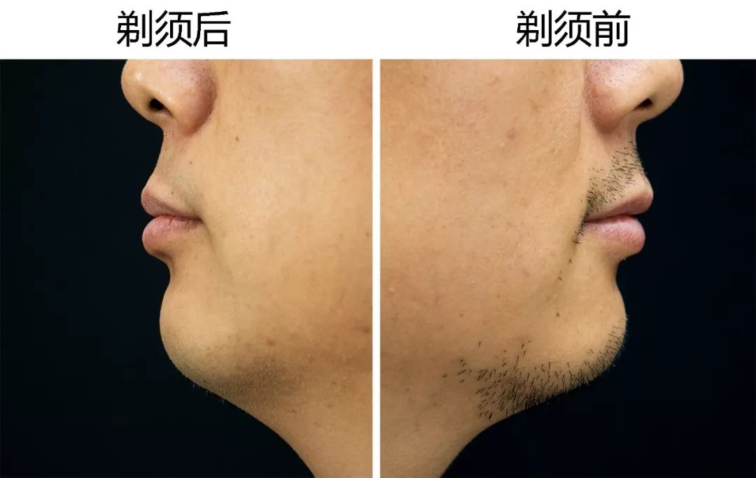 飞利浦s9000剃须刀刀头怎么拆开,飞利浦s9000剃须刀怎么连接蓝牙