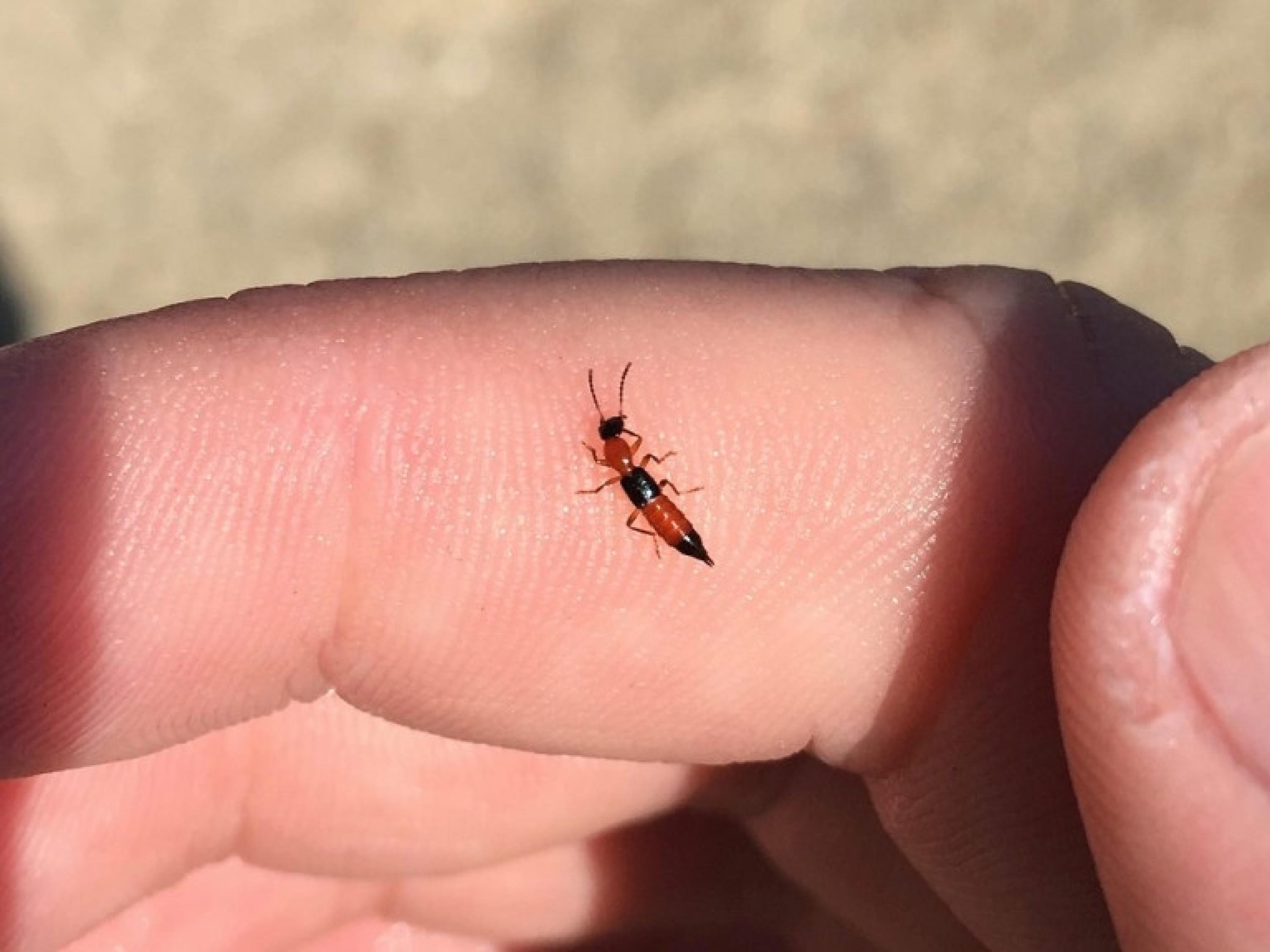 隐翅虫咬人后会发生什么症状,隐翅虫咬人会有什么症状