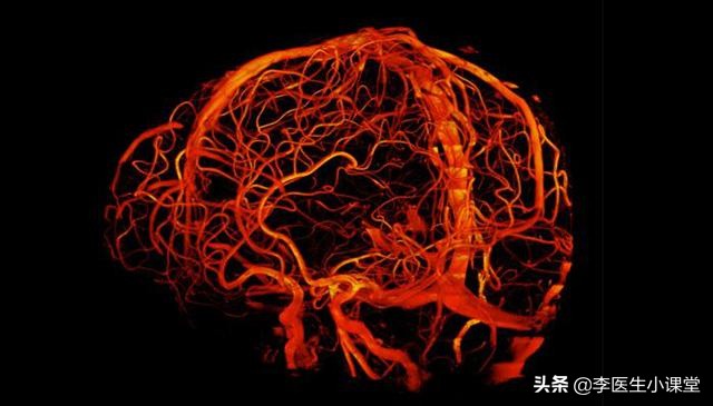 脑供血不足有哪些有效的治疗药物,治疗脑供血不足扩张血管的药物