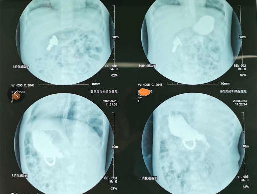 磁力珠对孩子危险吗,磁力珠对孩子有危险