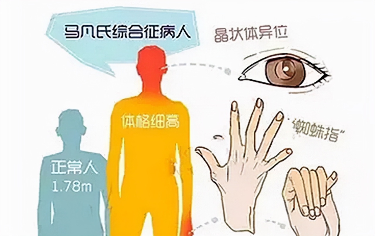 姚明郭士强完整视频,郭士强去世