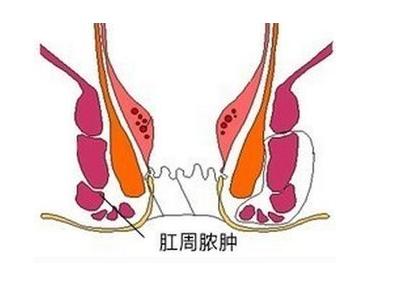 直肠指检百科,直肠指诊科普系列三