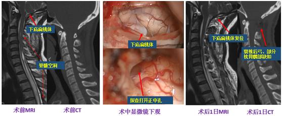 脖子总是疼痛引起头晕恶心,脖子总是痛头痛是什么原因