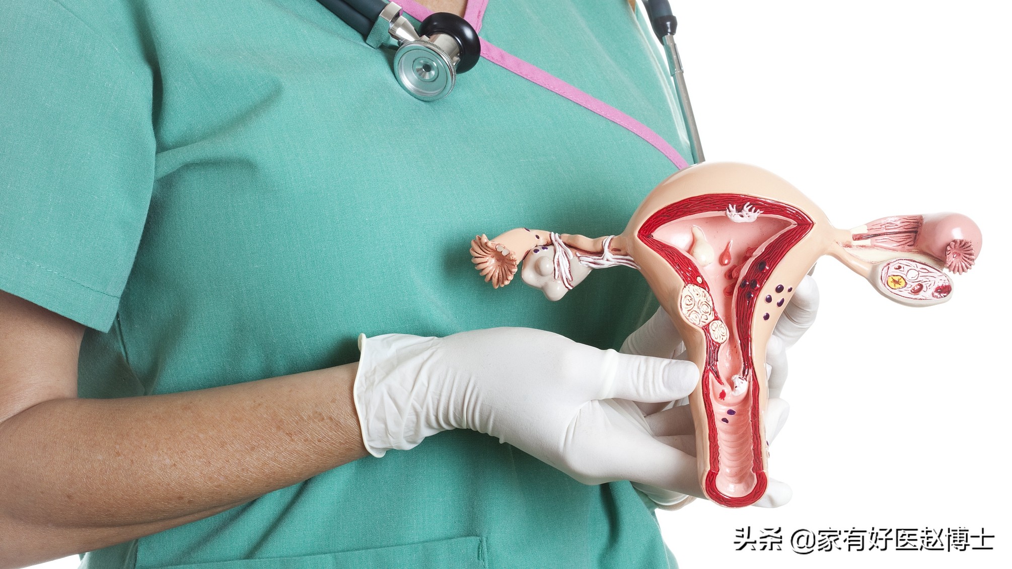 患癌最多的疾病以及预防,四种高致癌性炎症