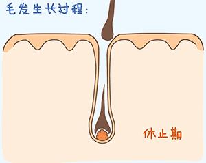 总熬夜导致脱发？这才是最有效的治疗方法