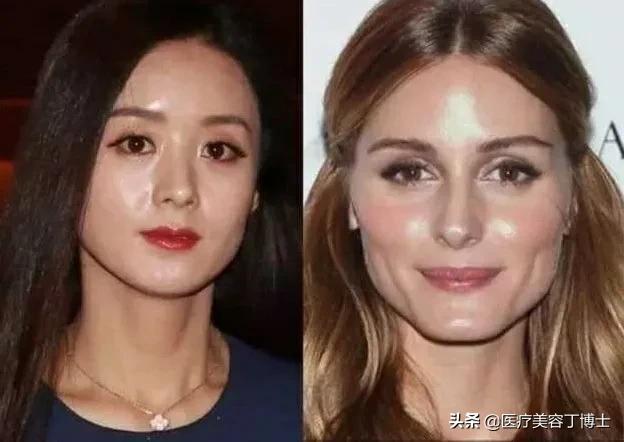 毛孔粗大皮肤又干是什么肤质,毛孔粗大的克星怎么解决