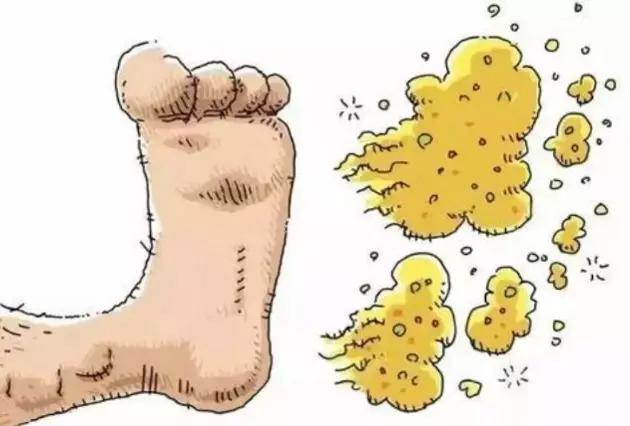 脚被真菌感染水疱型足癣多久才好,真菌足癣可以彻底解决吗