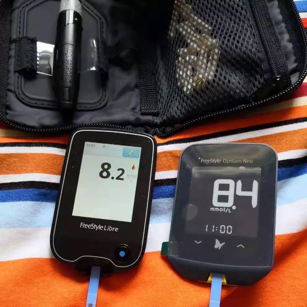 雅培动态血糖仪优缺点,雅培动态血糖仪测得准吗