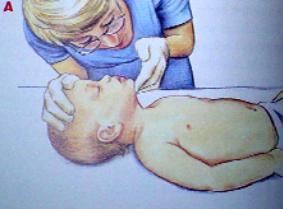 心肺复苏胸外按压的正确部位,电工考试心肺复苏的正确步骤