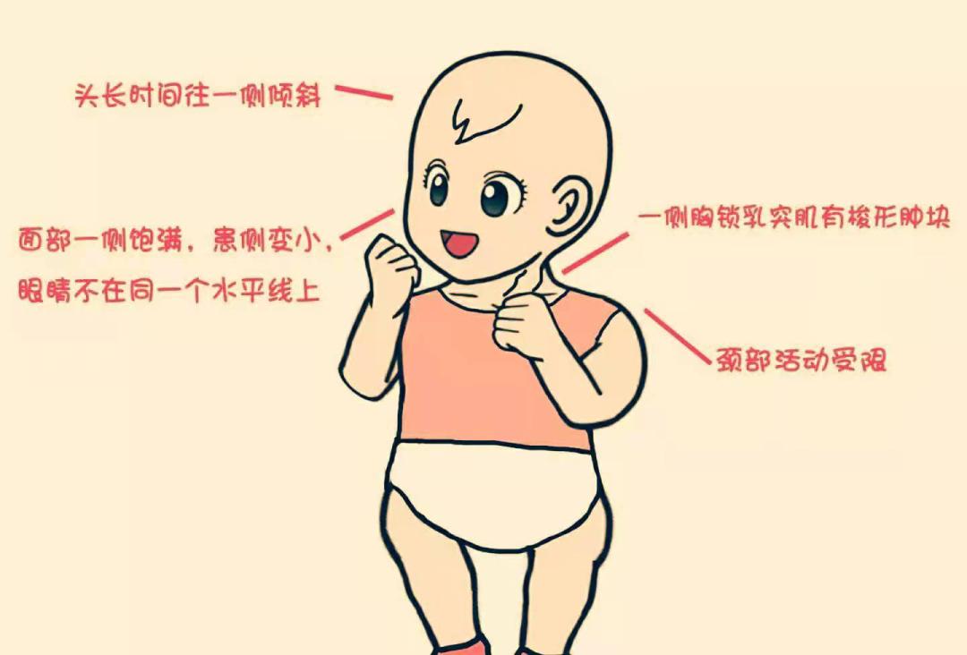 宝宝歪脖怎么纠正最有效,宝宝歪颈怎么纠正