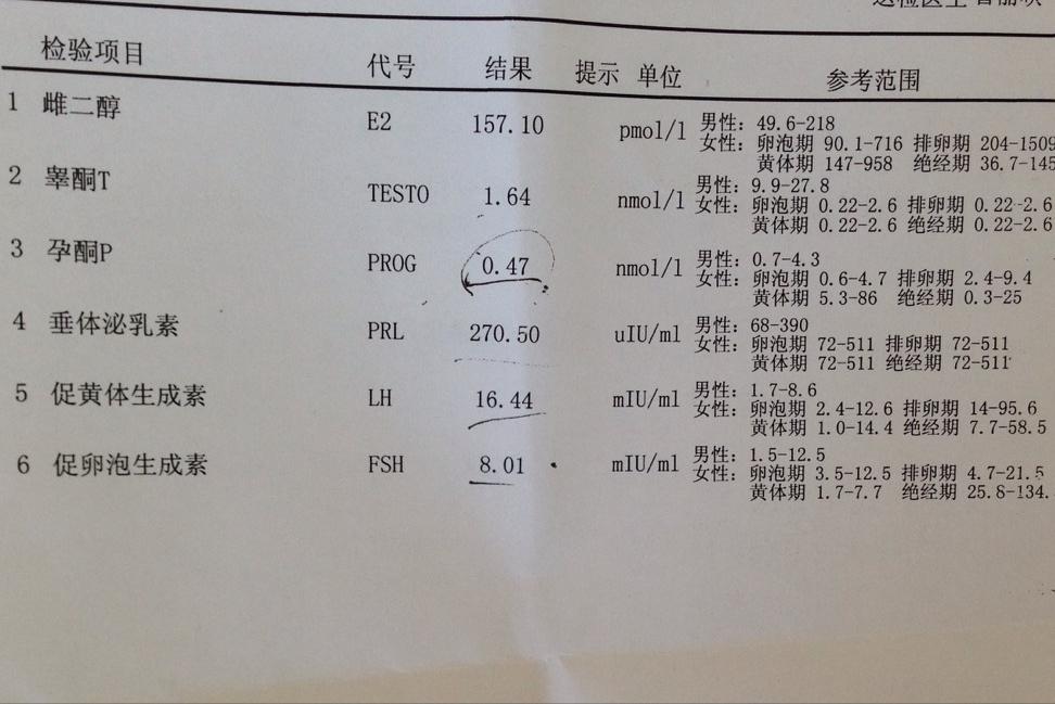 多囊卵巢综合症检查结果单,多囊卵巢综合症报告单怎么看
