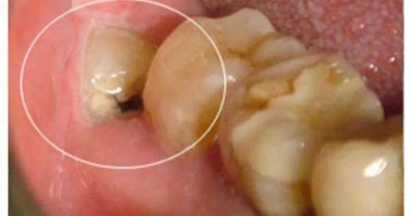 口腔垃圾怎么处理,口腔护理中的垃圾怎么分类处理