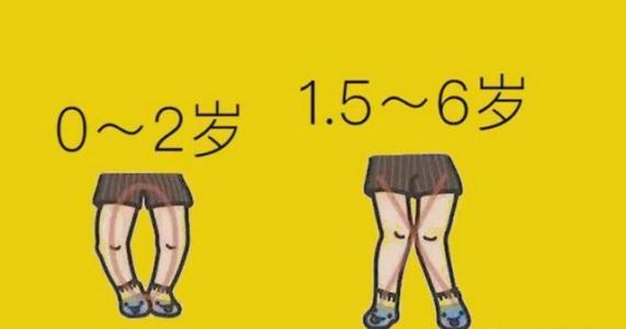 孩子腿有点o型腿该怎么办,七岁孩子xo型腿怎么矫正