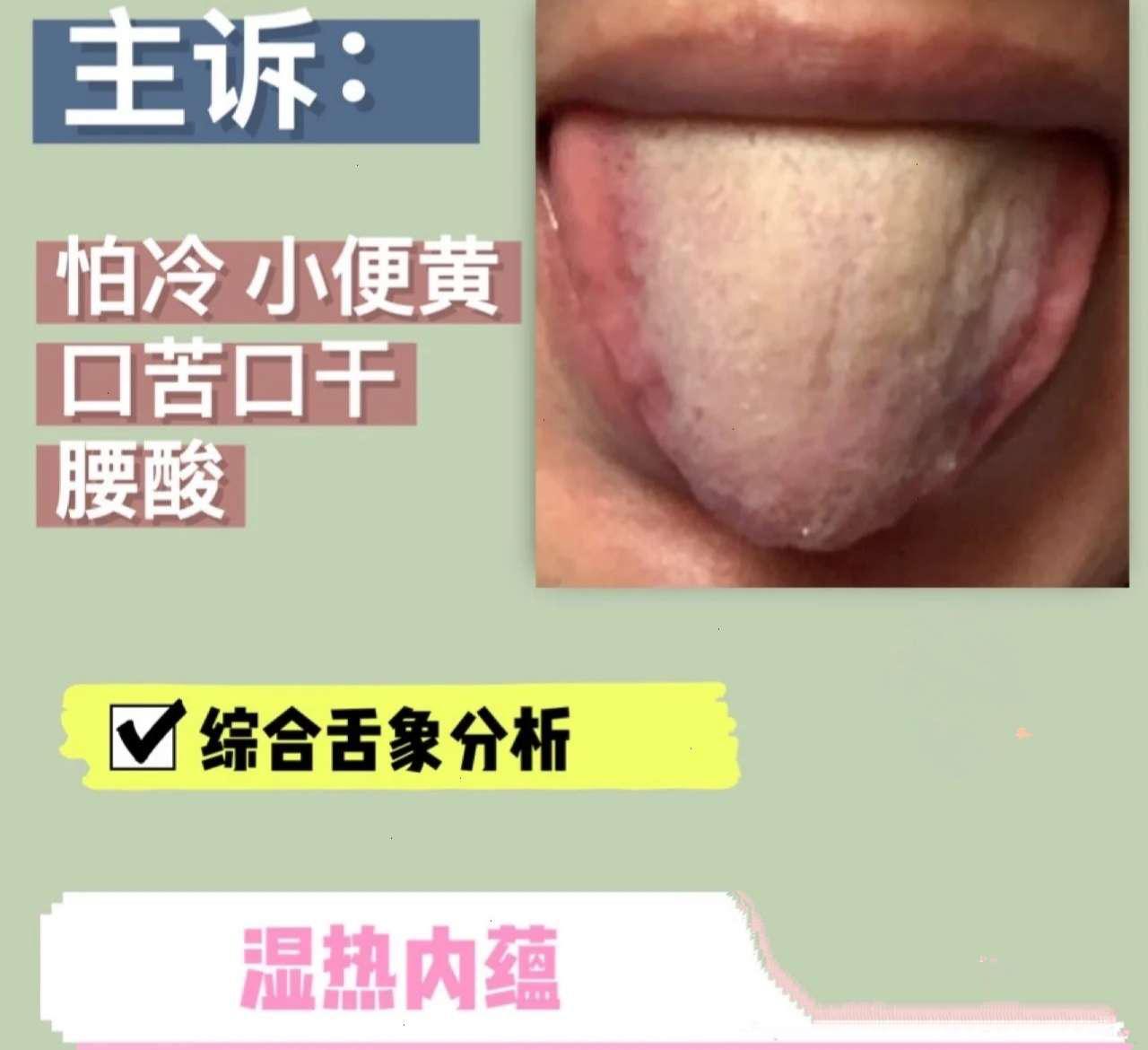肾阳虚腰痛与肾阴虚腰痛的区别,男人腰疼是肾阴虚需要吃什么药