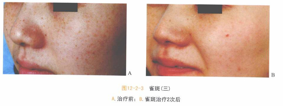 做了它，能让我的皮肤年轻十岁吗？