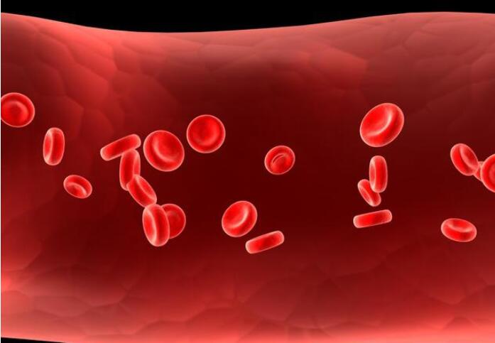 新生儿黄疸严重应该要注意些什么,新生儿黄疸如何去得快一招搞定