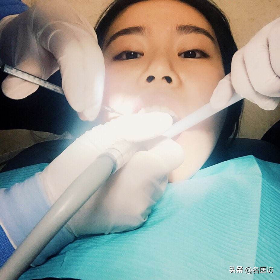 我怀孕四个月感冒了怎么办,怀孕四个月牙疼怎么回事