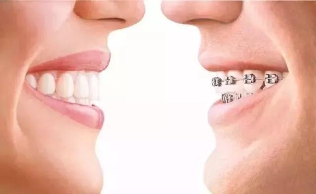 隐形矫正的不适应症,隐形矫正眼镜能看到什么