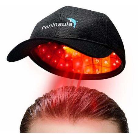 90后脱发自救指南 (90后的脱发历程一步一坑)