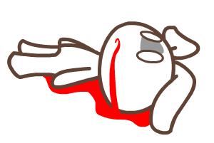 24岁小伙健身逞强脏器撕裂事件,小伙健身导致肌肉撕裂