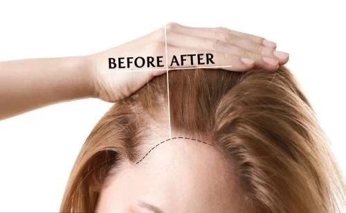 比较好用的德国防脱发,德国十大最好用的护肤品