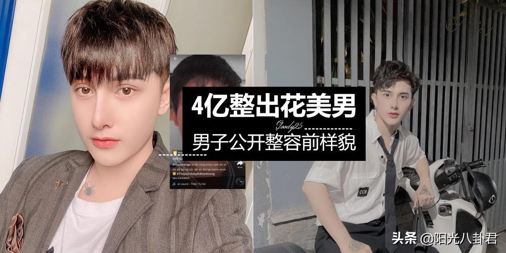 丑男整容变帅哥前后对比,丑男整容变帅哥对比照