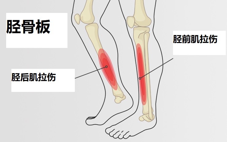 儿童胫骨疼痛一招立马缓解,孩子前胫骨中间疼痛怎么解决