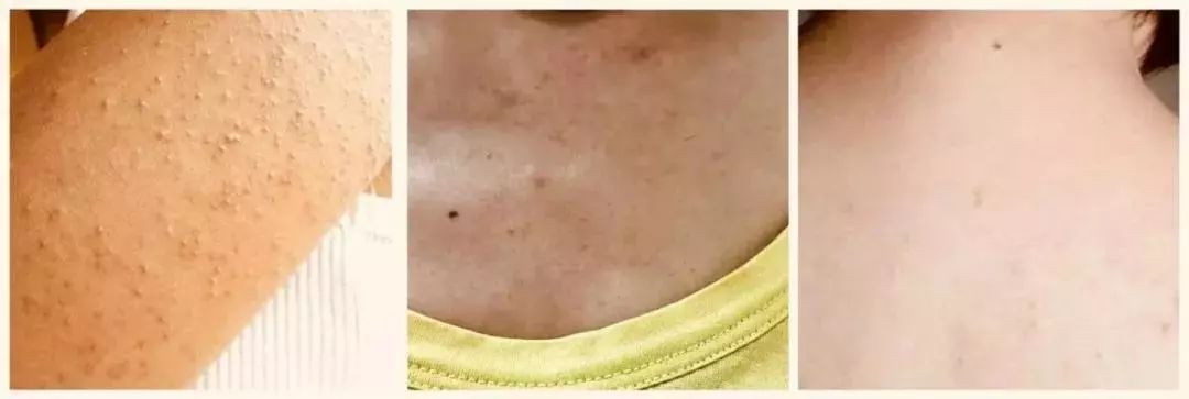 王鸥露背照片,王鸥最新露背写真