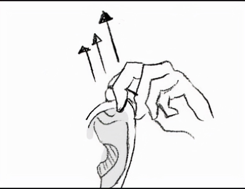 神经性耳鸣为什么无法治愈,为啥神经性耳鸣听力有时正常