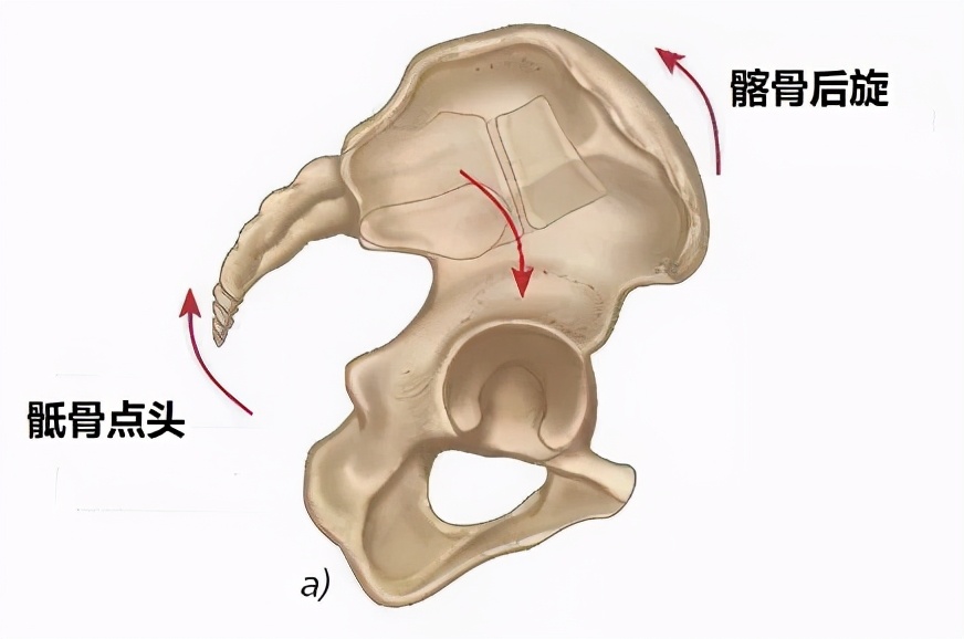 生宝宝选择剖腹产也需要做盆底肌修复，越早越好莫拖延