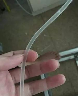 静脉输液时输入多少空气会出问题,静脉输入300ml空气会怎么样