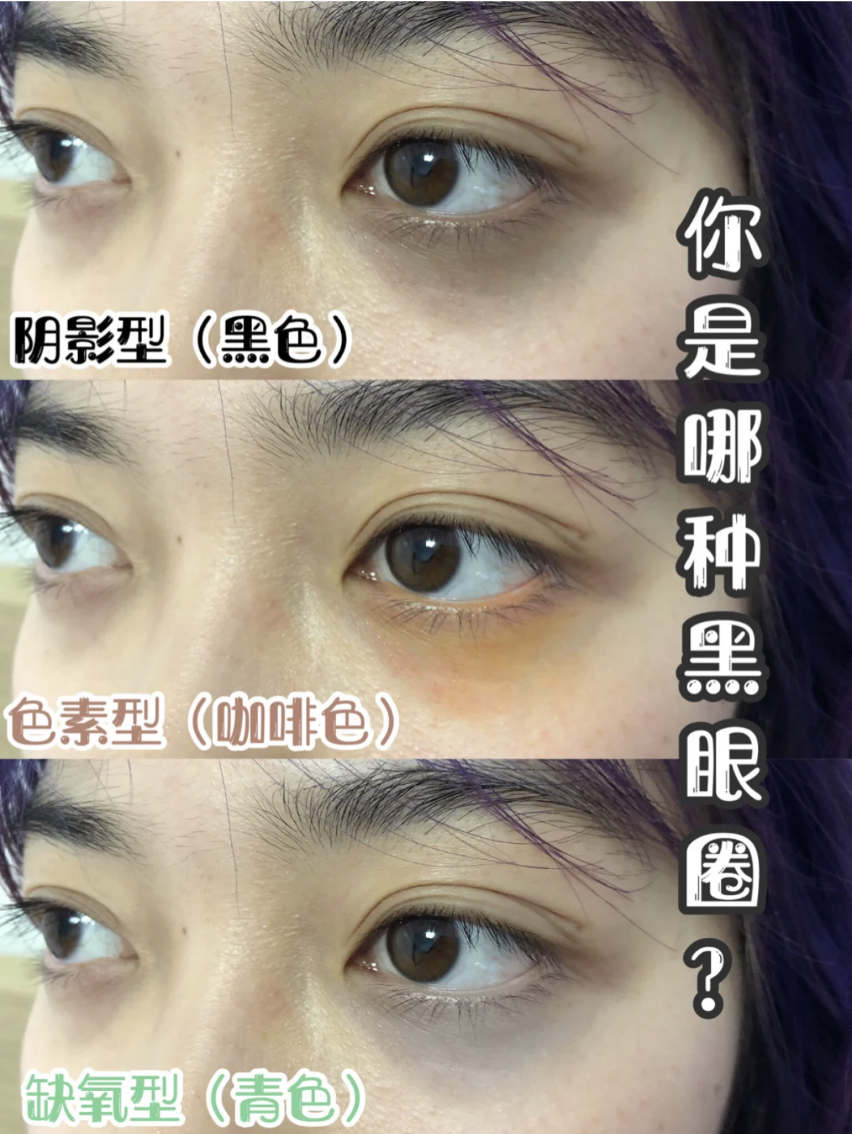 分享帖｜越用越严重？微信代购热卖的那些爆款眼霜，到底怎么回事