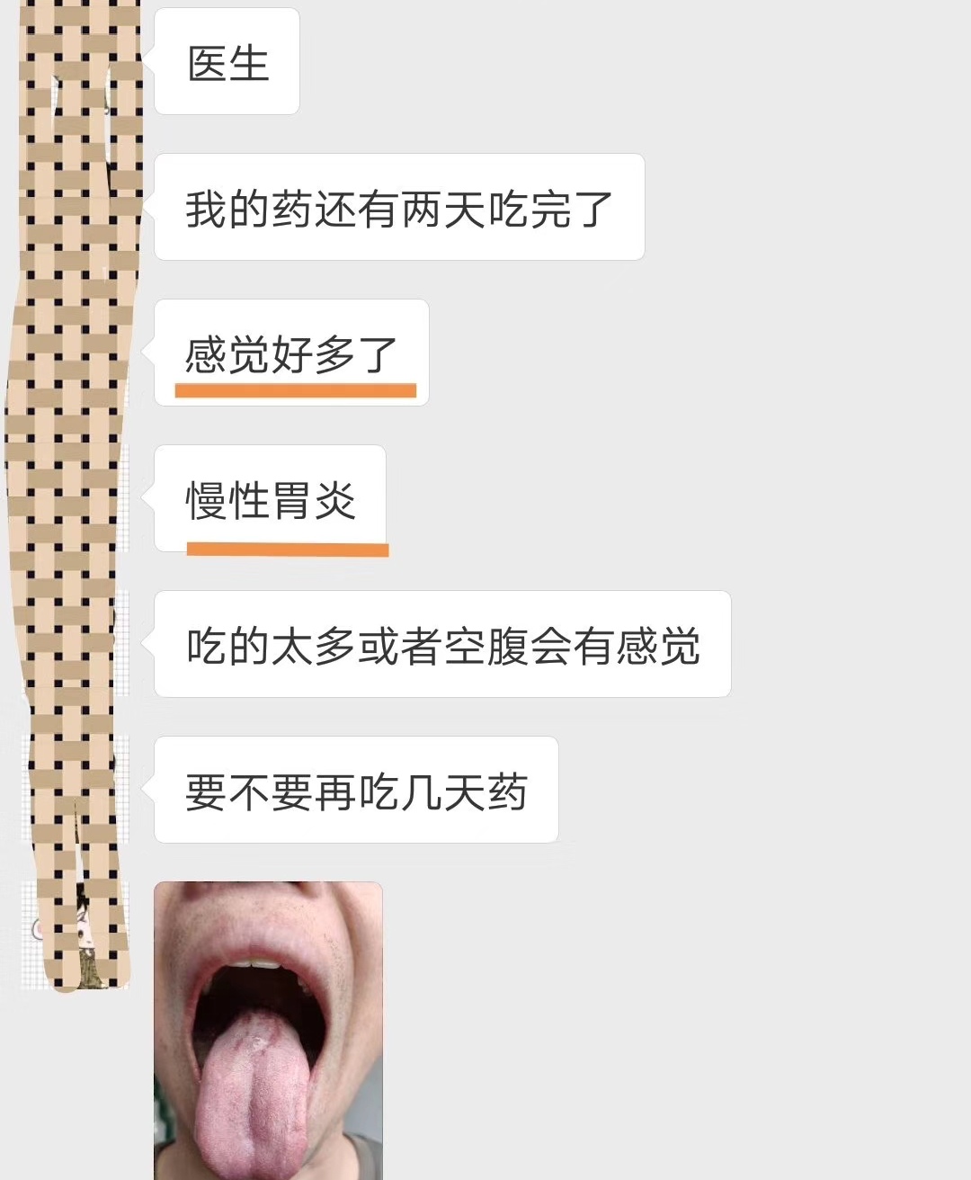 胃食管反流怎么治疗该服用什么药,胃反复发作吃药怎么吃法