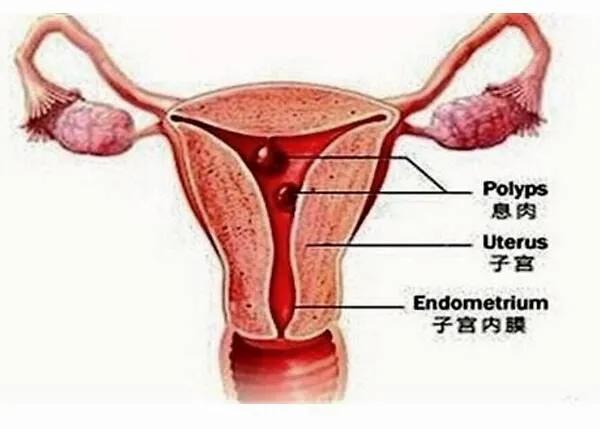 子宫内膜厚卵子容易着床吗,子宫内妊娠胚胎存活