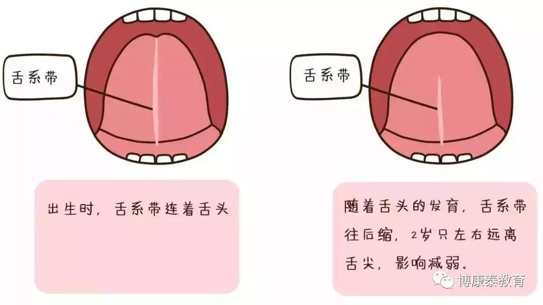 博康泰丨剪舌筋：该不该让孩子挨这一刀？