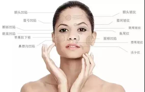 王菲代言的童颜针好吗,王菲童颜针后面部变化