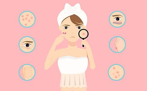 为什么脸上会长闭口粉刺,脸上闭口多怎么去除