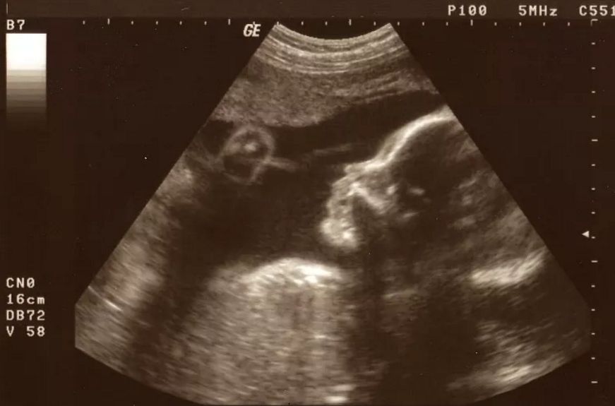 儿童性教育家长们该怎么教,儿童性教育家长听后感