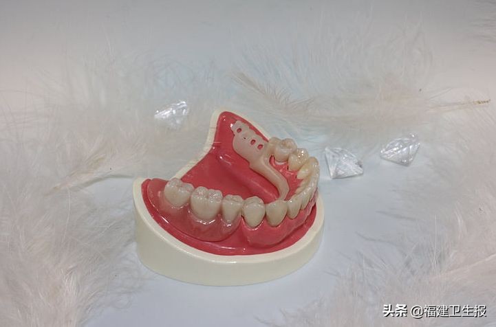 老人误吞假牙,大爷误吞两颗假牙