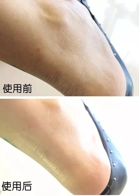 日本蜂王乳面霜,日本的霜好用不过敏干性皮肤用