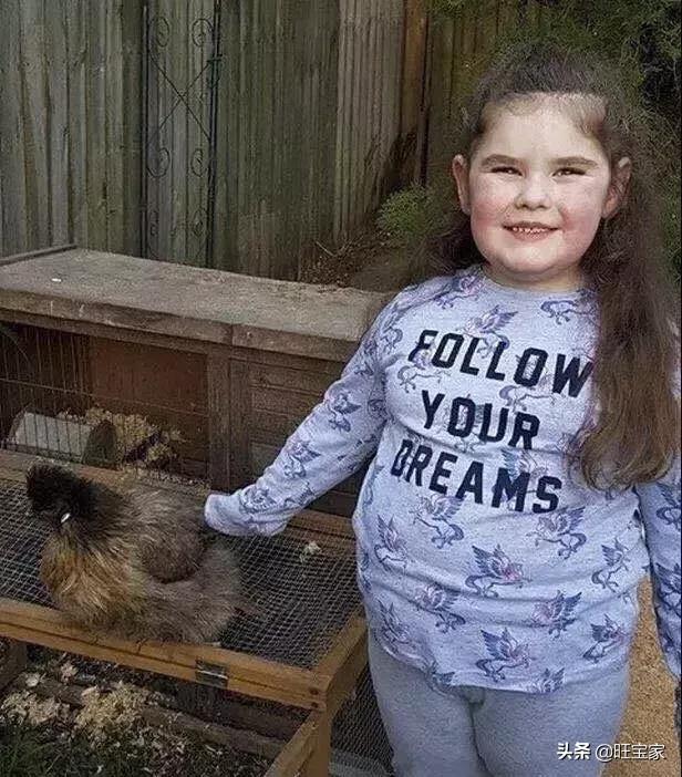 孩子长得高发育快,不一定是好事,还得警惕性早熟