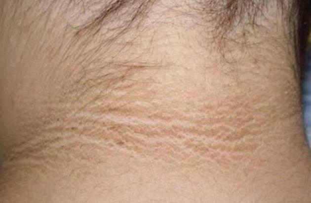 怀孕期间吃黑豆胎儿会变黑吗,孕妈妈为什么怀孕晚期皮肤黑了