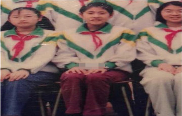 张碧晨鼻子怎么了,张碧晨鼻子怎么那么难看