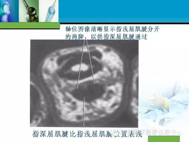 单只手指磁共振,手指用磁共振能做出来结果吗