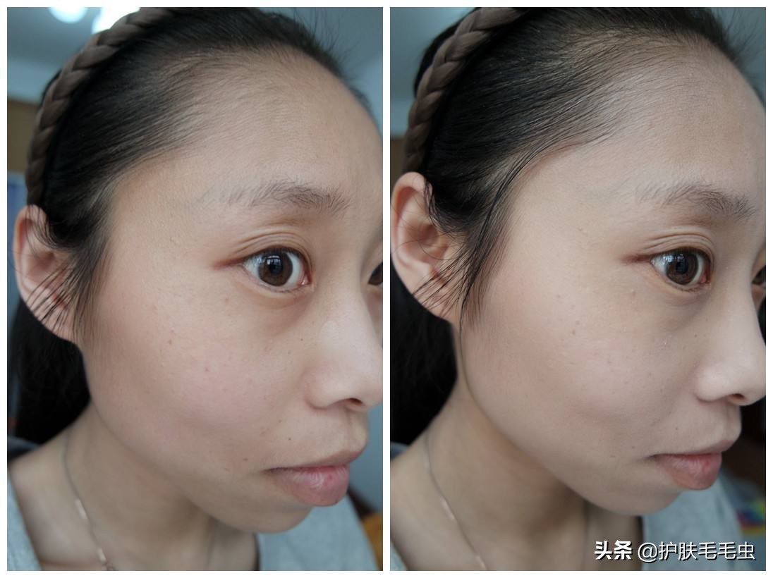 推荐一下祛斑的方法,祛斑最有效方法用哪个产品好