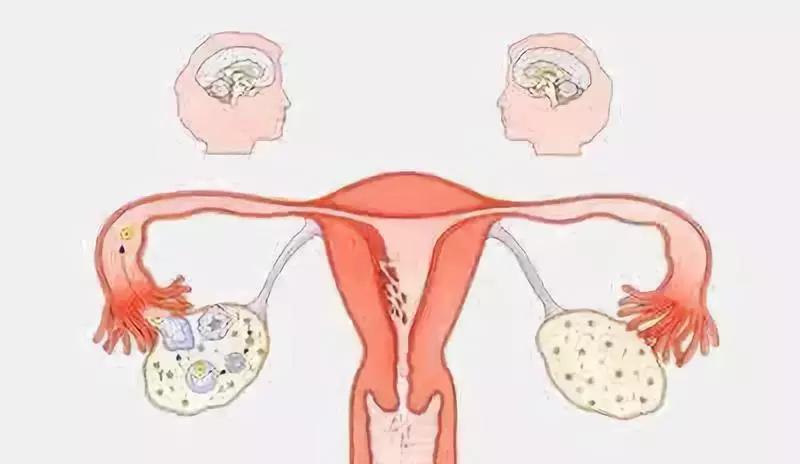 女人上环后身体会排斥，三招做好保养！你都知道？