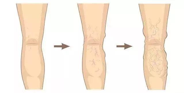 睡觉就可以练直腿,睡觉能睡出好身材吗