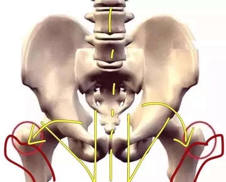 让腿又细又长,怎样锻炼可以改善假胯宽大粗腿