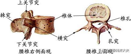 腰椎间盘突出最好的影像诊断方法,腰椎间盘突出的影像学检查