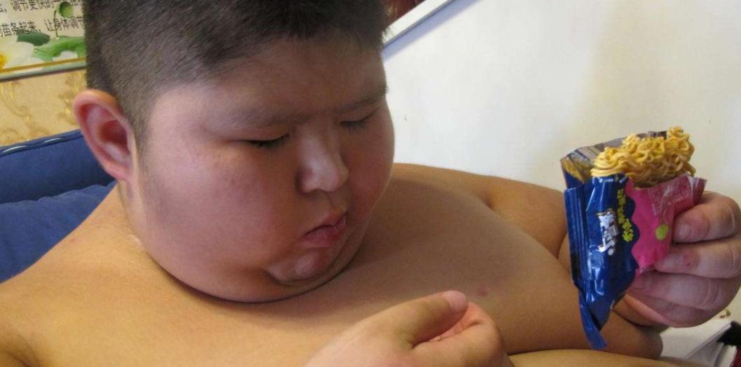 小胖威利症面容表现,小胖威利综合症是几岁开始胖的